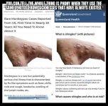 monkeypox28.jpg