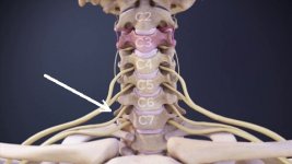 Cervical Nerves (C1-C8).jpeg